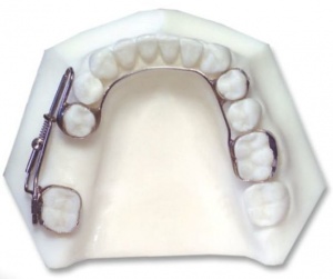 Аппарат для закрытия промежутка Mesial Jet (арт. 855-522)