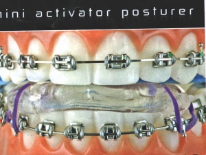 Приспособление Mini-Activator Posturer (M.A.P.) 852-609